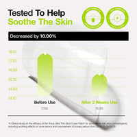 [Anua] Ultra Thin Spot Cover Patch 75ea